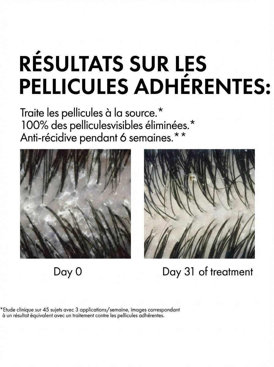 DERCOS SHAMPOOING ANTI-PELLICULAIRE DS CHEVEUX SECS 200 ML