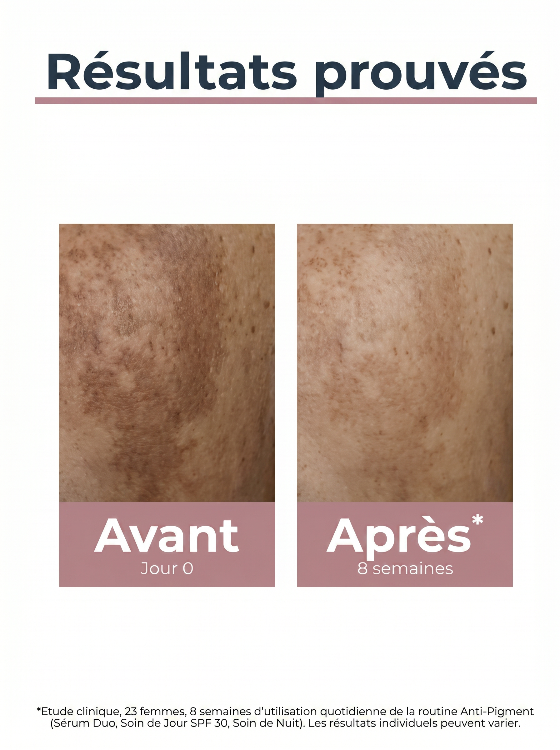 EUCERIN ANTI-PIGMENT SOIN DE JOUR SPF 30 - 50 ML